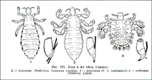 Какие виды вшей существуют: что нужно знать о них