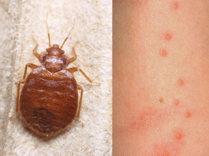 Какой размер у постельного клопа? Узнайте все подробности!